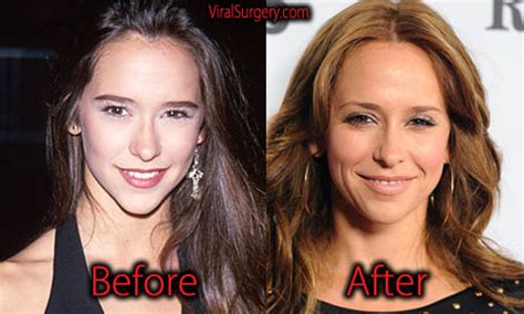 has jennifer love hewitt had plastic surgery|Jennifer Love Hewitt Addresses Plastic Surgery Speculation 